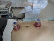 ��������aѪ�B���������g