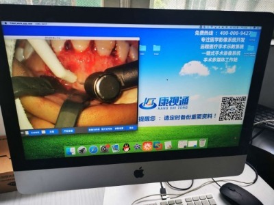 4K���g(sh��)�D(zhu��n)��ʾ��ֱ��ϵ�y(t��ng)