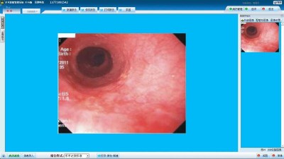 ���gӰ�����ϵ�y