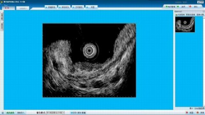 眼科超聲影像工作站