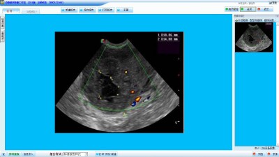 動(dòng)物超聲影像工作站 18005215661
