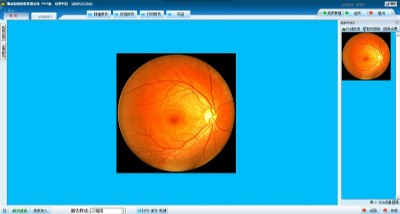 �۵������D�����ϵ�y(t��ng) 18005215661