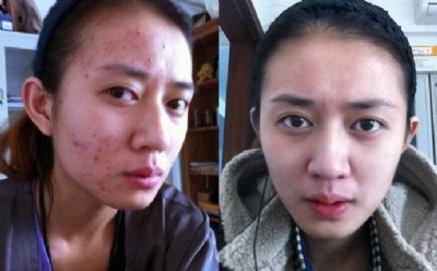 ������ه��Ƥ��