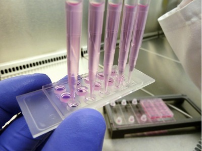 µ��-slide Ѫ�������d��Ƭ��81506