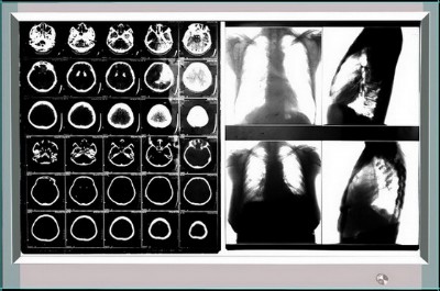 �pled�^Ƭ��