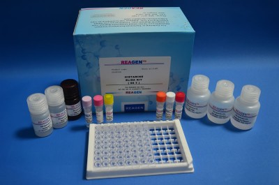 ����REAGEN�������@ELISA�z�yԇ����,���؏��ԙz�y�r