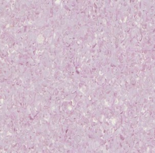 �o������ͬ�|͸�����z�ذ�ͨ͸pvc�ذ�