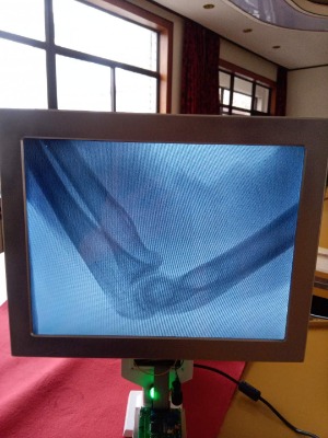 ����(y��ng)10������ǿ���֫��(f��)λ��ᘱ�yʽx��C(j��)