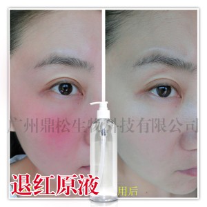 �˼tԭҺԴ�^�S���N��oem�ӹ��������˼t�[oem���ӹ�