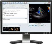 ���D�Ĉ�(b��o)��ϵ�y(t��ng)