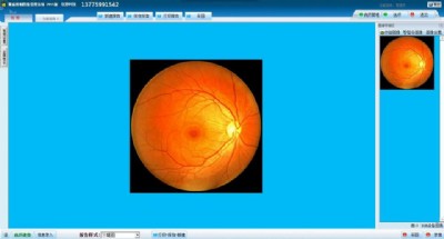 �۵������D�����ϵ�y