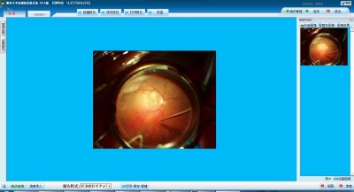 �ۿ����g(sh��)�@΢�R���ϵ�y(t��ng)