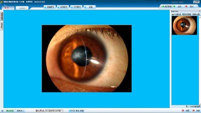 ��϶��D��̎��ϵ�y(t��ng)