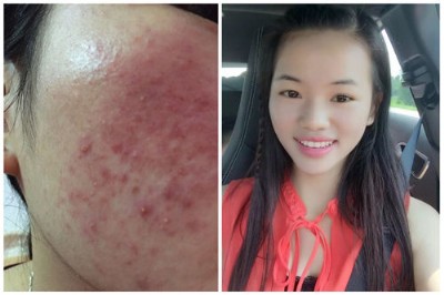 ������Ƥ��