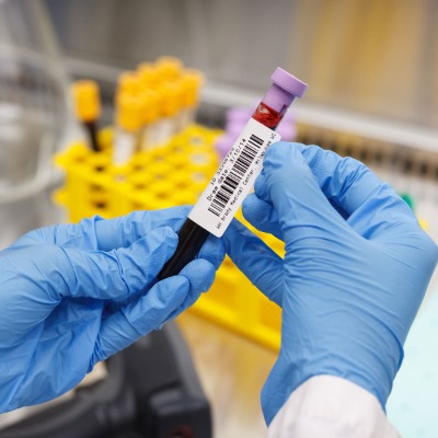 ���� b33 ��ӡ�C(j��)���ͻ��W(xu��)���g�͜ؾ۱�ϩ��(sh��)�(y��n)�Ҙ�(bi��o)��