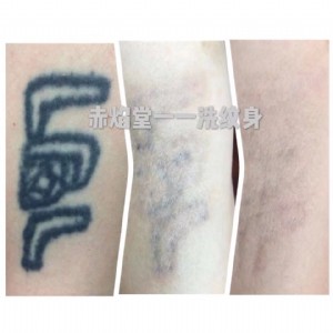 ��οƌW��ϴ�y��Ƥ�뼤��ϴ�y��